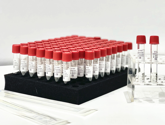 Uma extração Kit From Patient Pharynx Swab do PCR do reagente da liberação da amostra da etapa