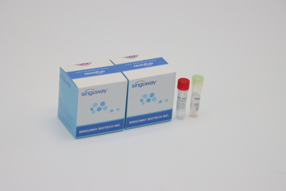 Jogo fluorescente quantitativo IVD da detecção do PCR para toda a Corona Virus Mutations