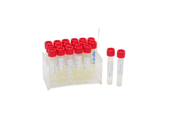 vírus 2mL descartável que prova o tubo de ensaio de Kit Medical VTM com a vara do cotonete da garganta