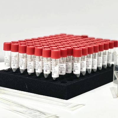 Tubo nasal do jogo 0.5mL/da extração do reagente da liberação da amostra do cotonete da faringe sem Preprocessing